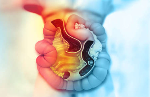 QFit Bowel Cancer Home Test Kit UK QFit Bowel Cancer Home Test Kit UK